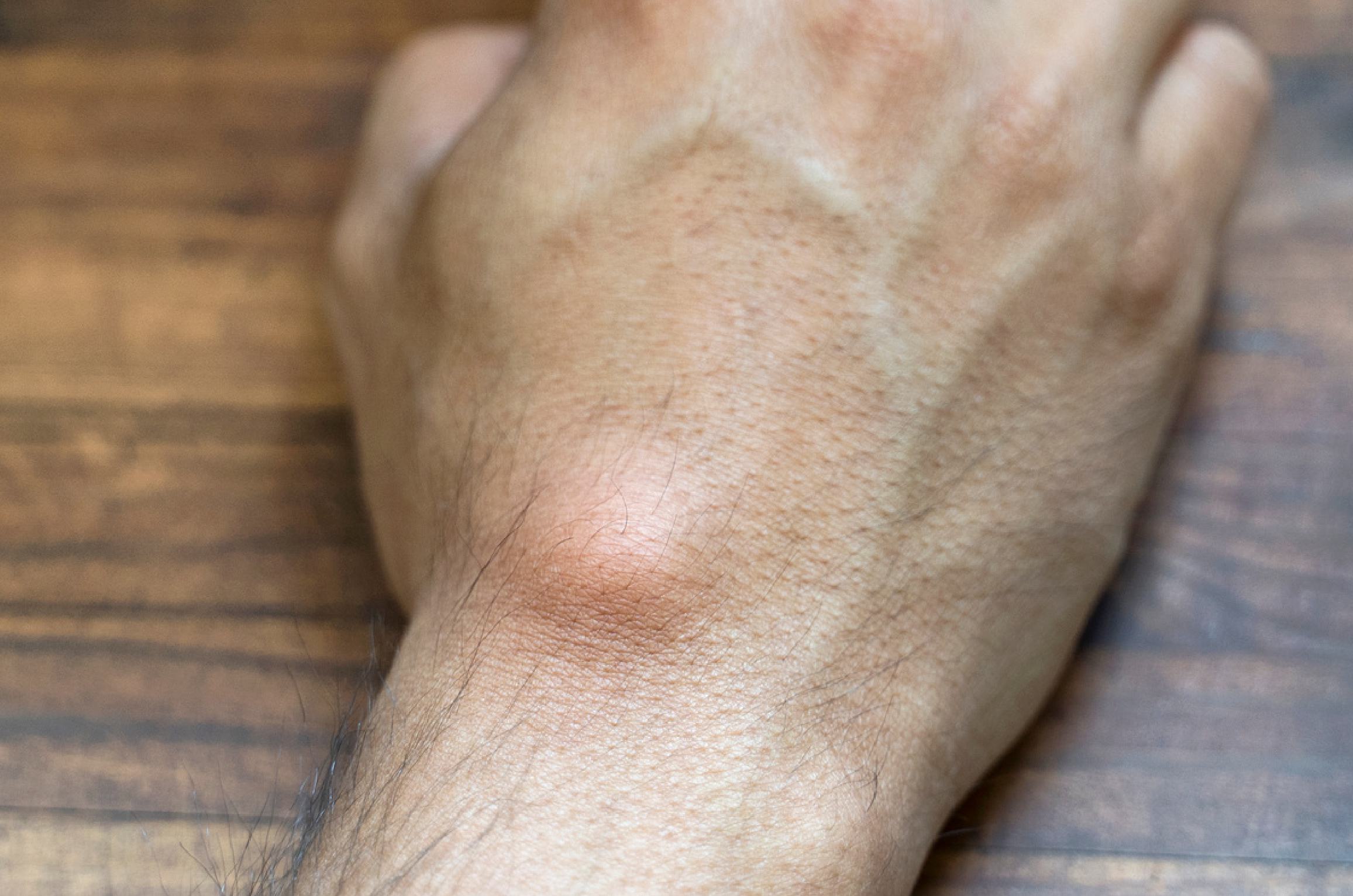 Dr. Shirisha Skin, Hair & Laser Clinic