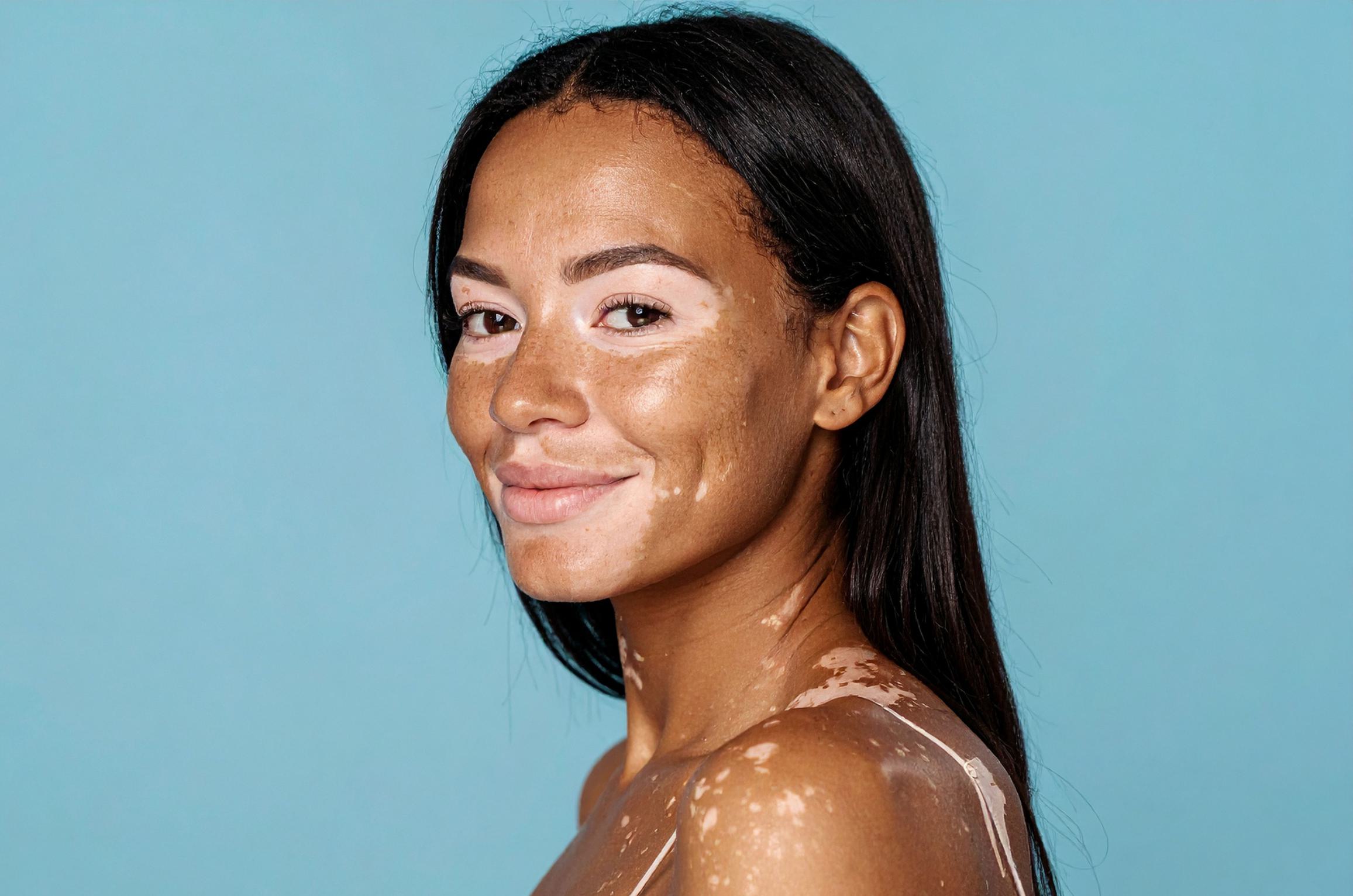 Dr. Shirisha Skin, Hair & Laser Clinic