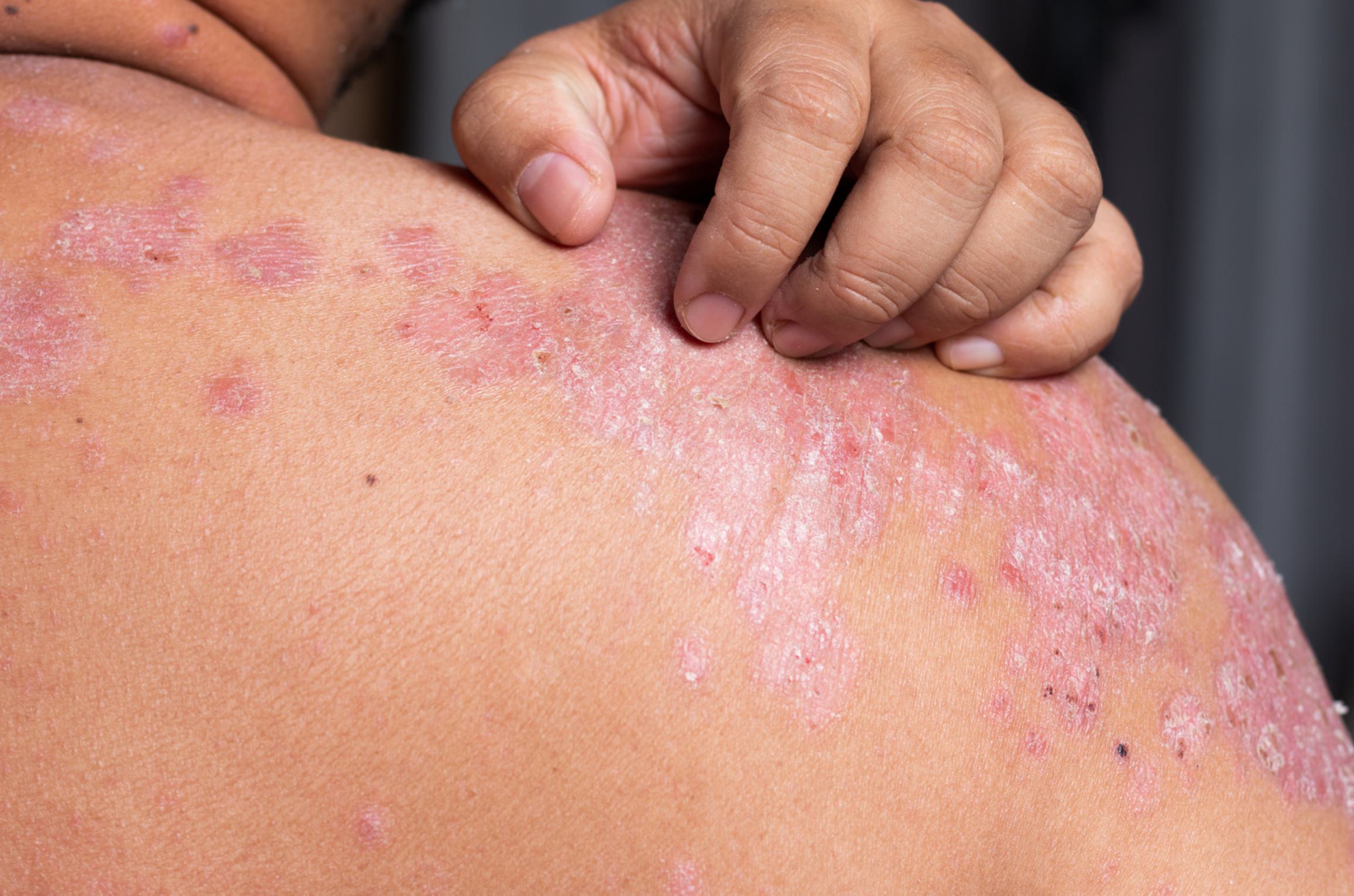 Dr. Shirisha Skin, Hair & Laser Clinic