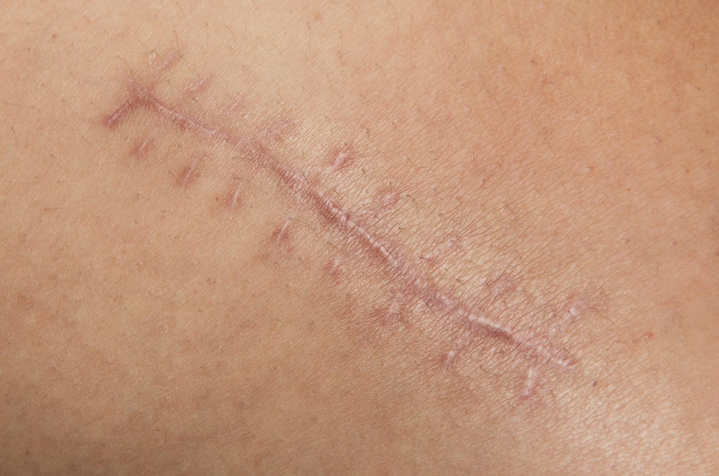 Dr. Shirisha Skin, Hair & Laser Clinic